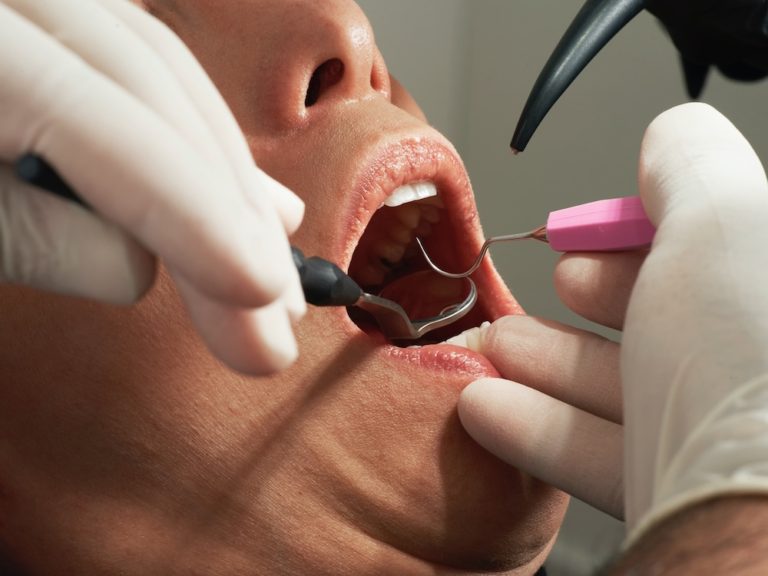 Dental treatment